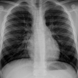 Radiografía de la columna lumbar fotografías e imágenes de alta