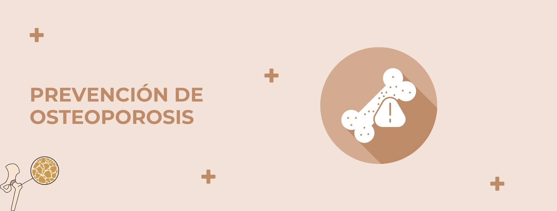 Hospital en Acapulco | Hospital privado | Prevención de osteoporosis